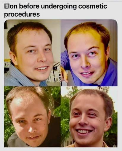 16294